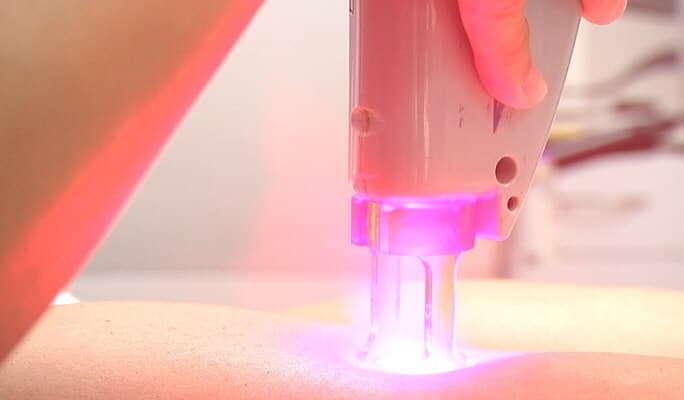 K-Beauty: Laser Hair Removal in Gangnam - main view