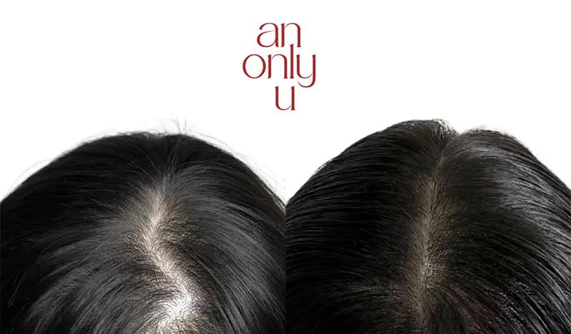 Hairline Contouring (SMP)/ Beauty Mark Tattoo at A:OU Studio in Hongdae - main view